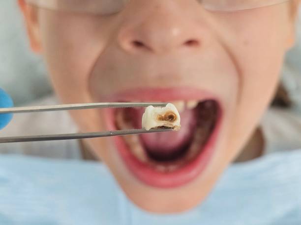 Best Broken Tooth Emergency  in Plainfield, IL